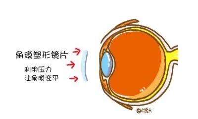 进出口眼镜报关如何归类？